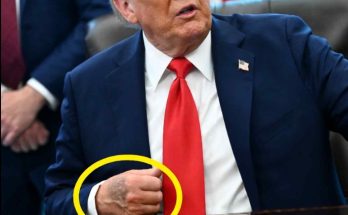 man in suit with tattooed hand during press event